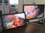 3Dの手術映像（左:腎ガン切除、右:心臓バイパス手術）